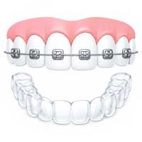 Orthodontics