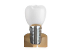Dental Implant